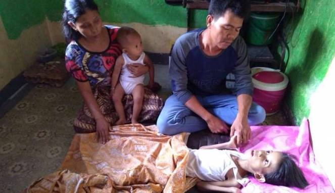 Bocah Penderita Gizi Buruk di Padang Butuh Uluran Tangan