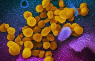 Belum Ditemukan Obatnya, Ini Dia Penampakan Jelas Virus Corona yang Kini Tengah Menyebar