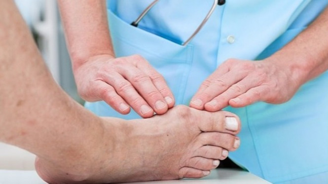 Waspadai, 3 Jenis Asam Urat Kronis yang Mungkin Anda Alami