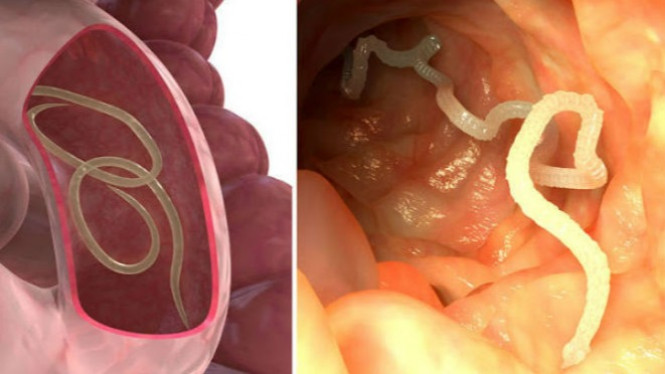 5 Bahan Alami untuk Keluarkan Parasit dengan Cepat