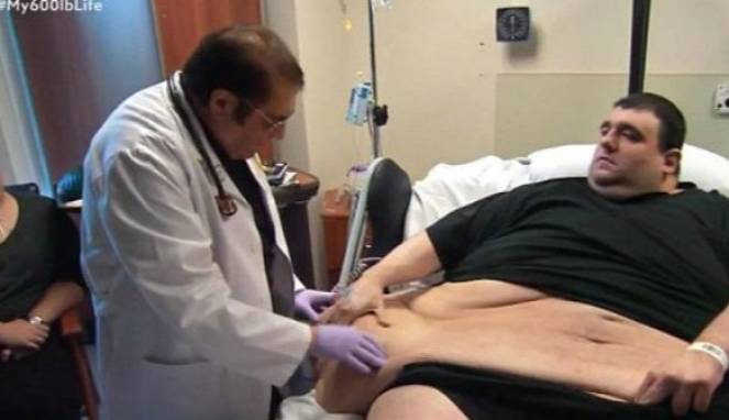 Pria Obesitas dengan Berat 420 Kg Meninggal Dunia