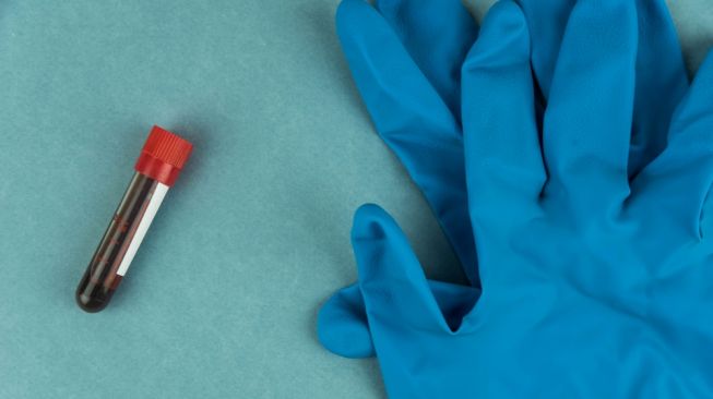 Malaysia Tak Percaya Rapid Test Bisa Deteksi Virus Corona