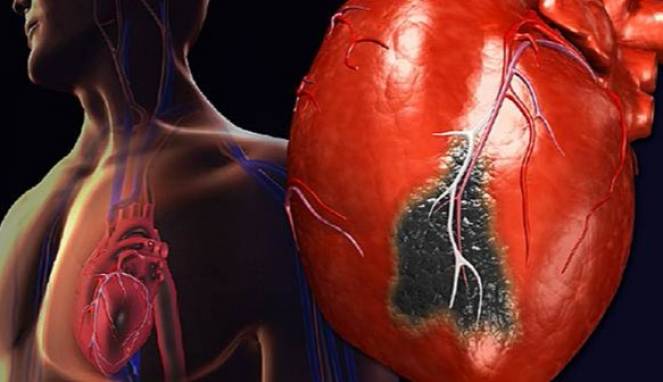 5 Makanan yang Merusak Kesehatan Jantung