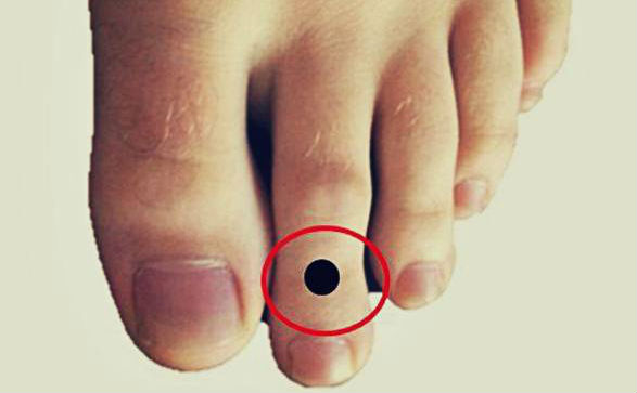 Jari Kaki Kedua Kamu Lebih Panjang dari yang Lain? Ini Artinya