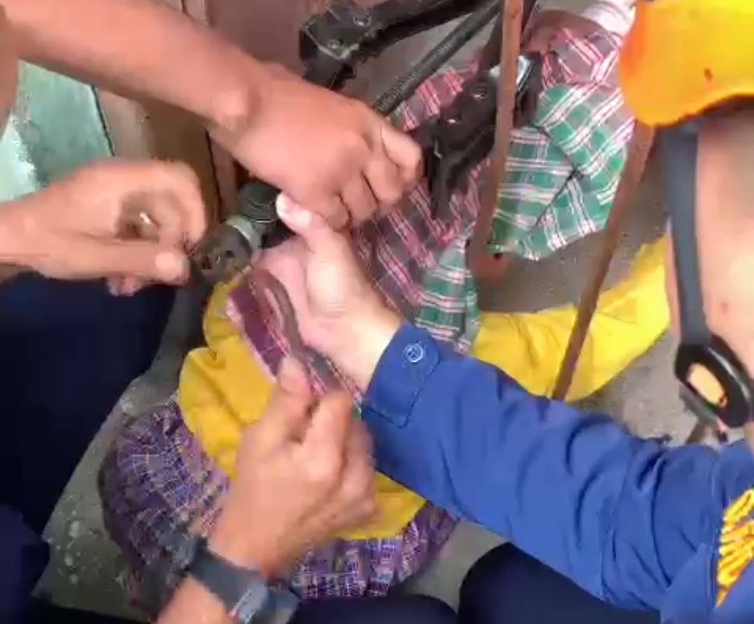 Damkar Pekanbaru Evakuasi Anak yang Kepalanya Tersangkut di Terali Pagar