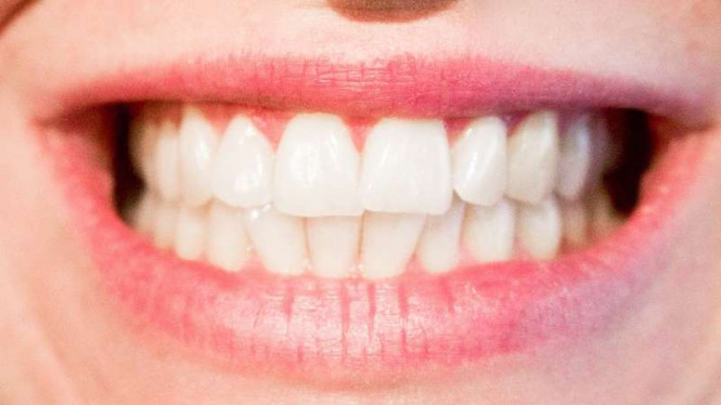 Membuat Gigi Kinclong dengan Dua Bahan Alami dan Murah
