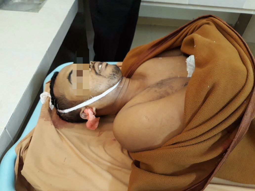 Inalillahi.. Korban Begal di Kubang Raya Pagi Tadi Akhirnya Meninggal Dunia