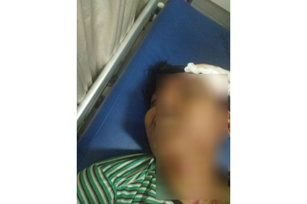 Lindungi Teman Wanita, Febri Dibacok Kawanan Bermotor
