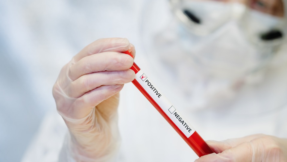 Pemprov Riau Dapat Pinjaman Alat PCR dari BBPOM Pekanbaru