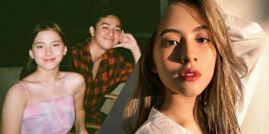 Setelah Video Tak Senonoh Miripnya Viral, Kini Netizen Soroti Tanda Merah di Leher Adhisty Zara