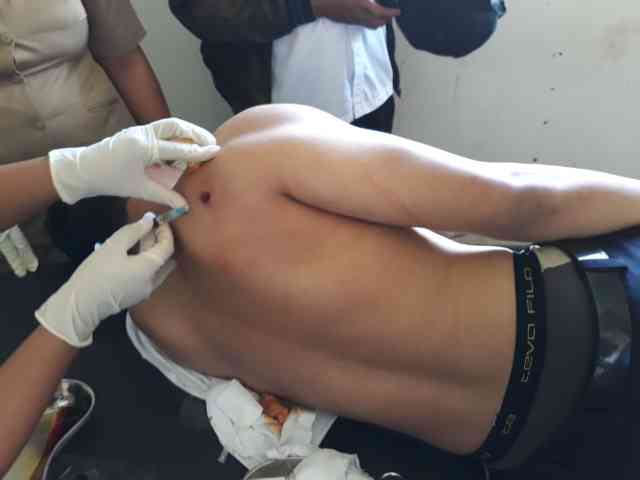 Pesawat Trigana Air Dihujani Tembakan Usai Mendarat, Pilot Terluka