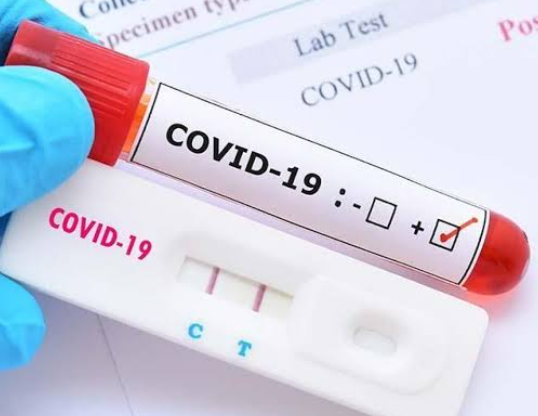 263 Warga Riau Terpapar Corona Hari Ini, 125 Diantaranya Pekanbaru dan 6 Meninggal Dunia