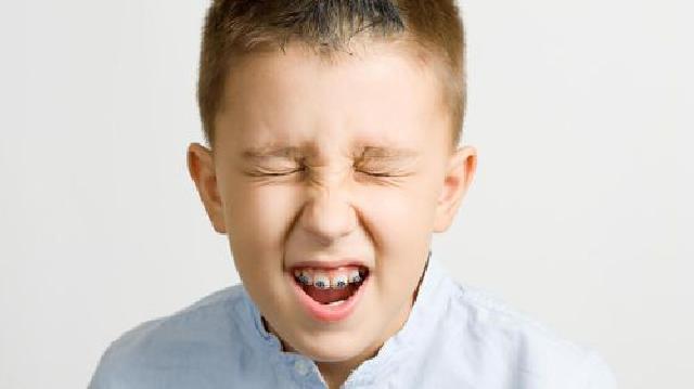 Aturan Makan yang Penting Diketahui Pengguna Behel