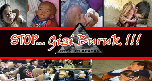 Adanya Temuan Anak Gizi Buruk, Menandakan Pendataan Masyarakat Miskin di Pekanbaru Tidak Maksimal