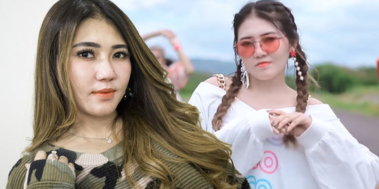 Tak Kuat Selalu Dapat Komentar Jahat, Via Vallen Nekat Lakukan Permak Wajah