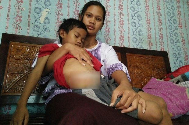 Derita Alif, Bocah Dengan Usus di Luar Perut
