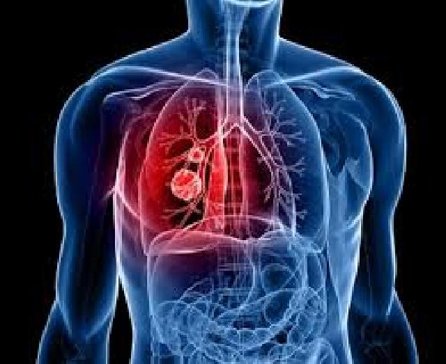 7 Tips Mudah Hilangkan Racun Di Dalam Tubuh Anda