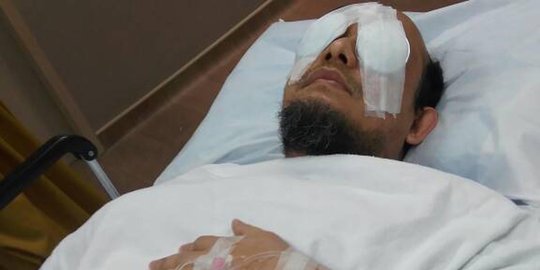 Pertumbuhan Selaput Mata Kiri Belum Maksimal, Novel Baswedan Kembali Jalani Operasi