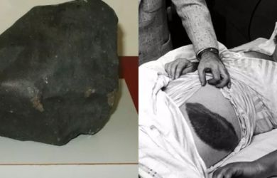 Penampakan Satu-satunya Manusia yang Pernah Ketiban Batu Meteor!