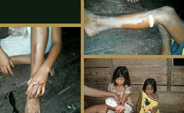 Mandi di Sungai, Dua Bocah Bersaudara di Inhil Diterkam Buaya