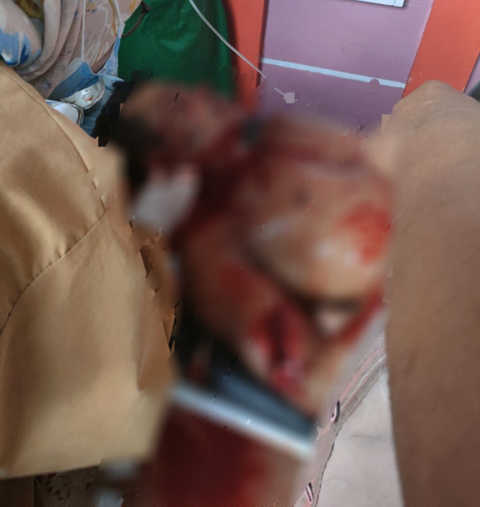 Penambang Emas di Kuansing Dibacok Rekannya