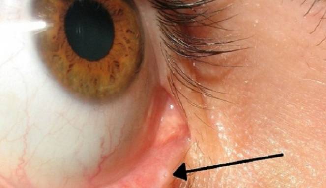 Ini Dia Fungsi Lubang Kecil di Bawah Kelopak Mata