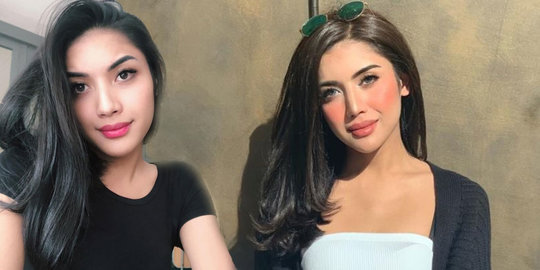 Millen Cyrus Operasi Ganti Kelamin