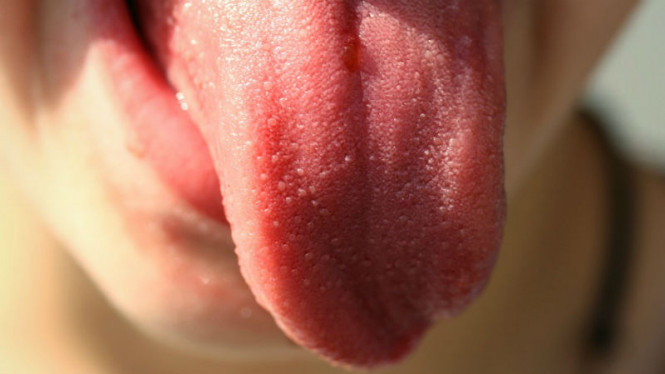 Waspadai Empat Masalah Aneh yang Menyerang Lidah