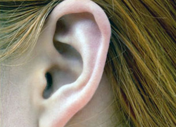 Ini Penyebab Jerawat Telinga dan Cara Mengobatinya