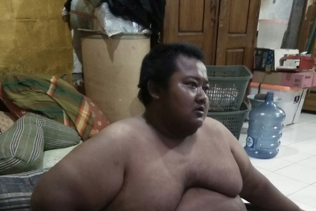 Yudi Hermanto Pasien Obesitas Berbobot 310 Kg Meninggal Dunia