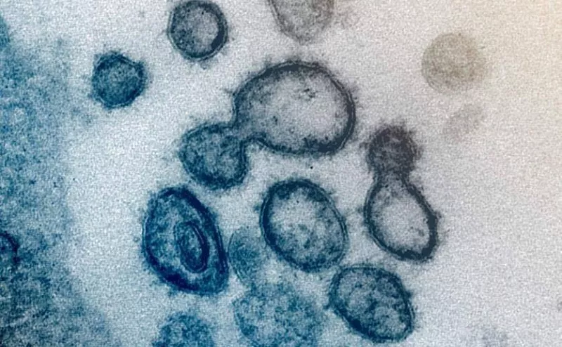 Tiga Gejala Long Covid-19 Terbanyak di Indonesia