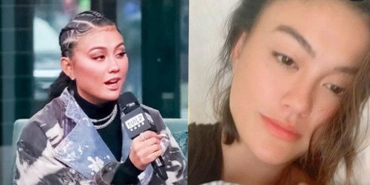 Kabar Duka Datang Dari Agnes Mo, Kehilangan Suara Hingga Tak Boleh Bernyanyi