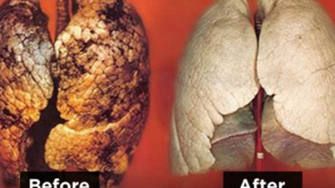 Ini dia Tips Membersihkan Paru-Paru Perokok dalam Waktu Dua Hari