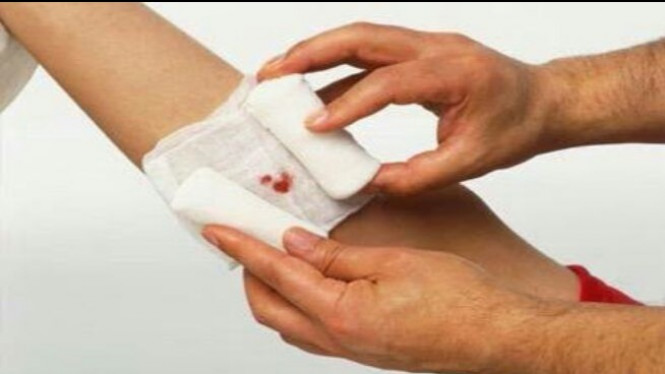 Terluka, Baiknya Diperban atau Dibiarkan Terbuka?