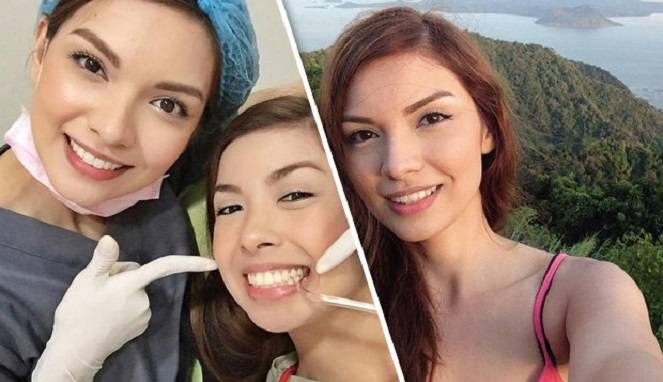 Yuk, Berkenalan dengan Marjan si Dokter Gigi Cantik di Dunia