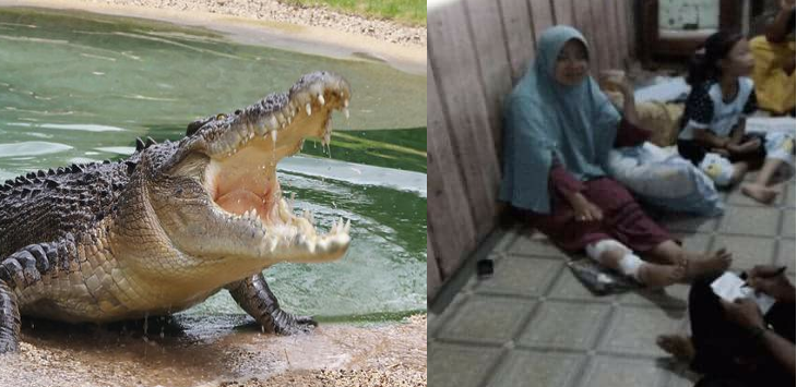 Kepala Dipegang, Mata Ditusuk! Perempuan Ini Lolos dari Gigitan Buaya