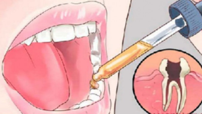 Cara Gunakan Cengkeh untuk Atasi Sakit Gigi dalam Sekejap