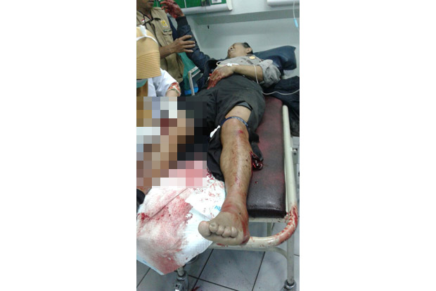 Bubarkan Tawuran, 2 Anggota Polisi Diserang Puluhan Remaja