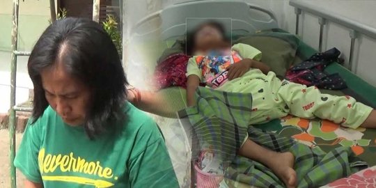 Badan Bocah 6 Tahun Ini Memar Setelah Dianiaya Ibu Kandung dan Ayah Tiri