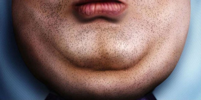 Para pria, jangan sampai punya dagu berlipat