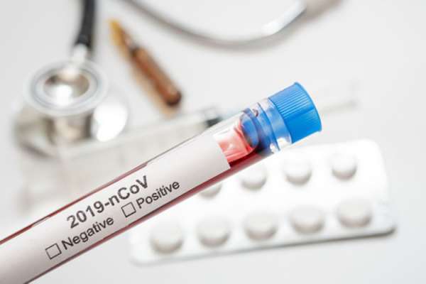 Peneliti Klaim Anjing Perantara Penyebar Virus Corona ke Manusia