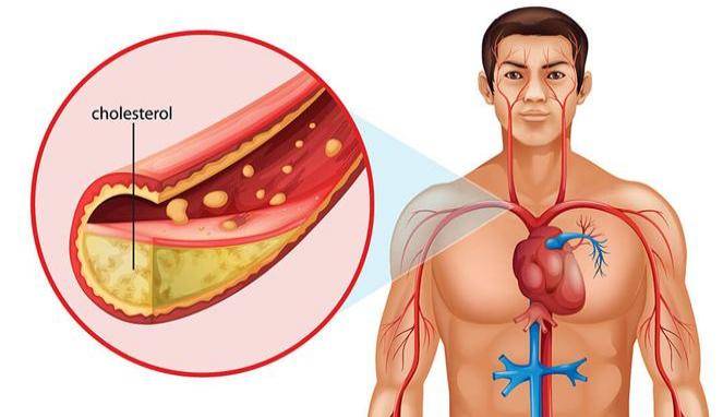Ini Dia Manfaat Cuka Apel, Selain Hancurkan Kolesterol