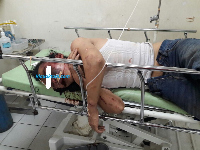 Pelaku Curanmor yang Babak Belur Pagi Tadi di Kuansing Bernama Nando Gustian