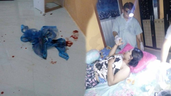 Dua Perempuan Jadi Korban Perampokan Sadis, Kondisinya Bikin Miris