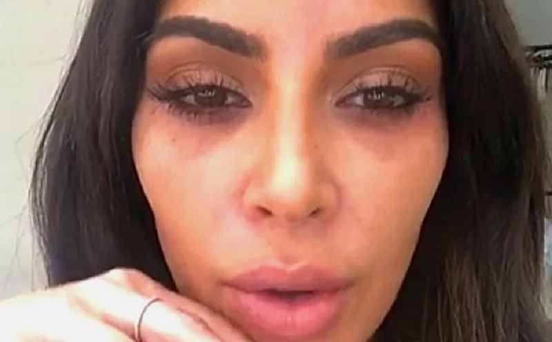 Berikut 3 Tips Alami yang Menghilangkan Lingkaran Hitam Mata