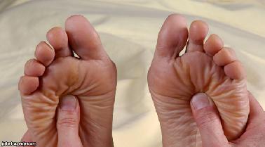 Gaya Hidup yang Salah Pendorong Neuropati