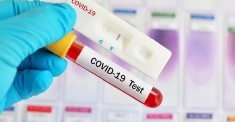 Dalam Sehari Kasus Corona di Riau Bertambah 300, Sembuh 145 dan 12 Meninggal Dunia