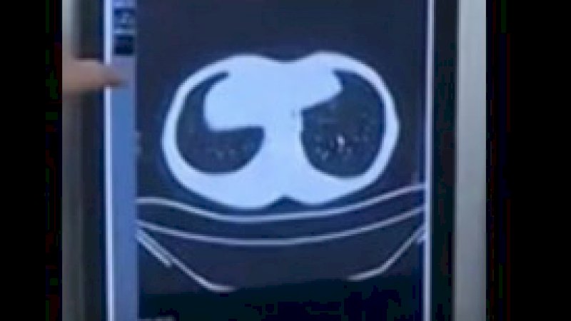 Duh! Paru-paru Pria Ini Penuh Cacing karena Gemar Konsumsi Makanan Mentah