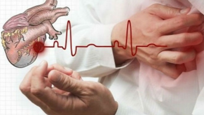 Alami Serangan Jantung, Lakukan Ini untuk Selamatkan Diri
