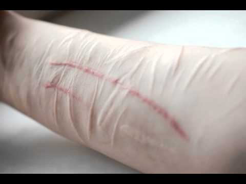 Ngeri, Diduga Kecanduan Minuman Kemasan, 56 Pelajar di Pekanbaru Sayat Tangan